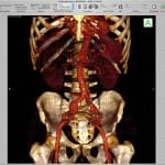 Zdjęcie okładkowe wpisu: Wyniki badań medycznych różnią się na makach i pecetach