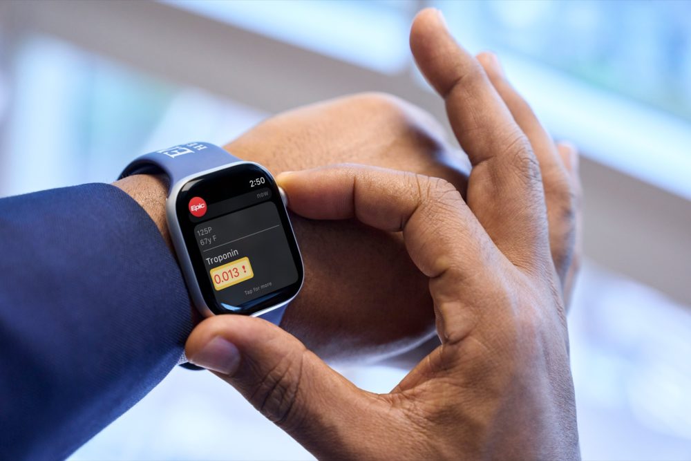 Zdjęcie okładkowe do wpis Apple Watch pomógł Harvardowi zbadać wpływ menopauzy na&nbsp;sen —&nbsp;94 000 nocy danych