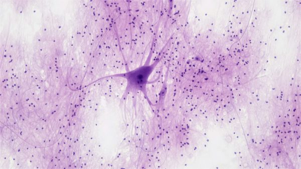 Neuron. Fot. Bioscience Image Library by Fayette Reynolds / Unsplash